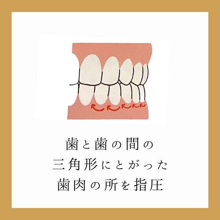 画像1563
