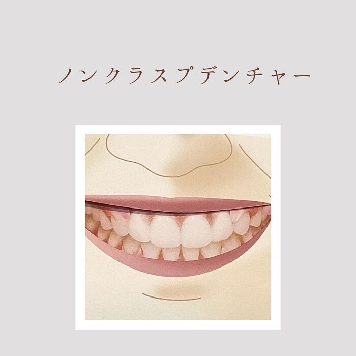 画像1662
